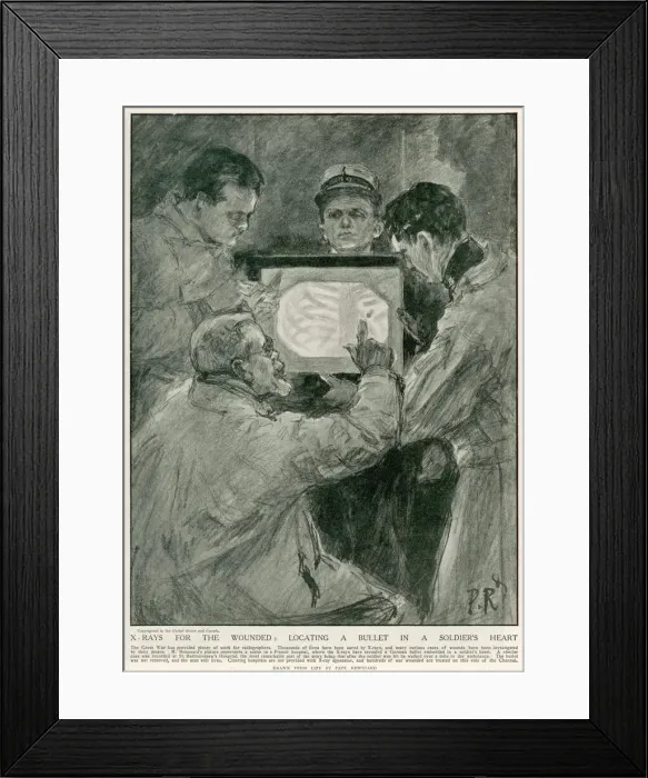 Framed Print : Soldier X-Rayed / 1915 Framed Print : Soldier X-Rayed / 1915