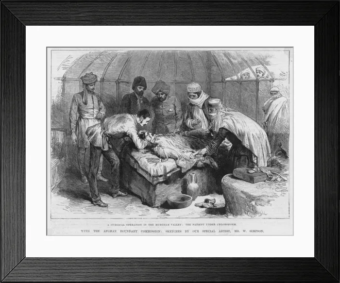 Framed Print : Surgery / Chloroform / 1885 Framed Print : Surgery / Chloroform / 1885