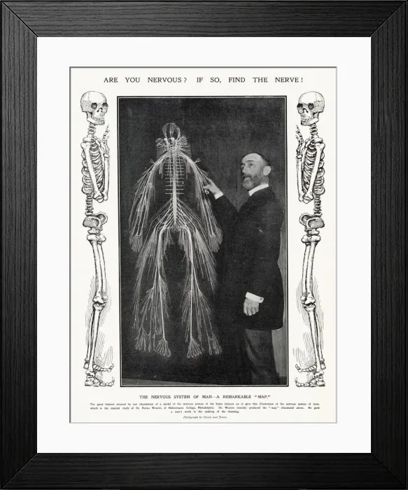 Framed Print : Are you nervous? If so, find the nerve! Photograph of Dr Framed Print : Are you nervous? If so, find the nerve! Photograph of Dr