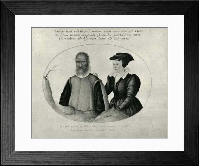 Framed Print : Pedro Gonzalez, the hairy man Framed Print : Pedro Gonzalez, the hairy man