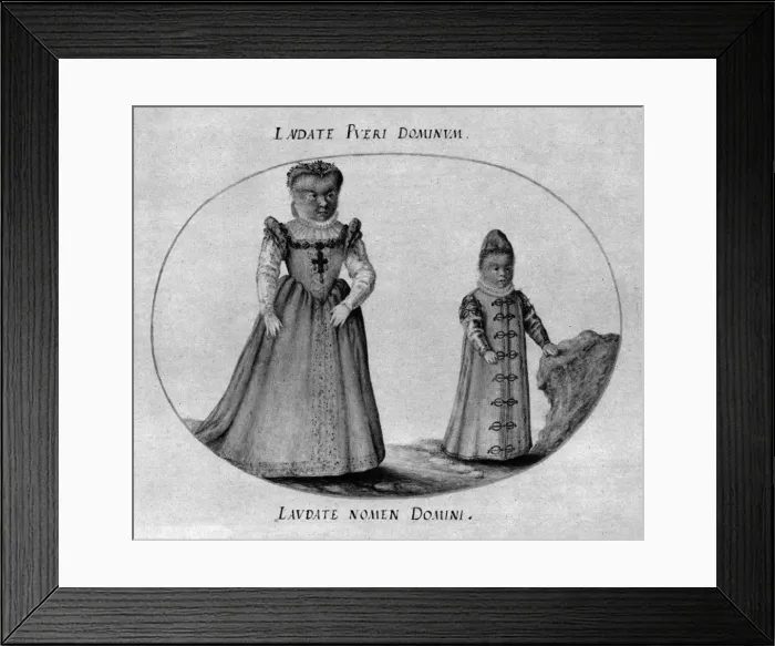 Framed Print : Hairy children of Pedro Gonzalez Framed Print : Hairy children of Pedro Gonzalez