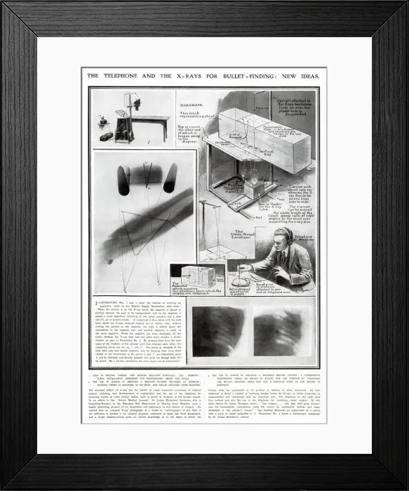 Framed Print : New Ideas for using X-Rays for Medical use WWI Framed Print : New Ideas for using X-Rays for Medical use WWI