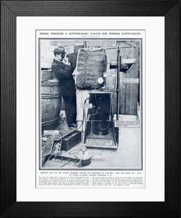 Framed Print : X-ray had proven useful in World War One, for locating bullets Framed Print : X-ray had proven useful in World War One, for locating bullets