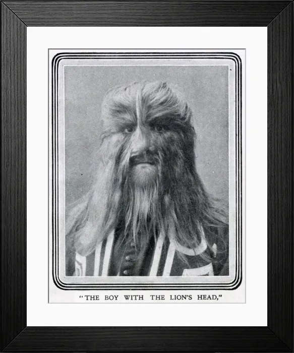 Framed Print : Stephan Bibrowski (1890 - 1932), know as Lionel the Lion-faced Man Framed Print : Stephan Bibrowski (1890 - 1932), know as Lionel the Lion-faced Man