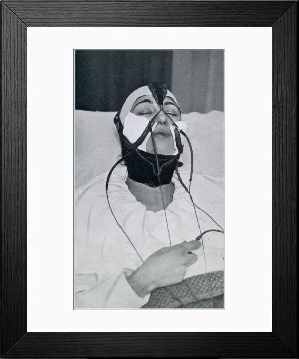 Framed Print : Apparatus for the Removal of the Double Chin 1927