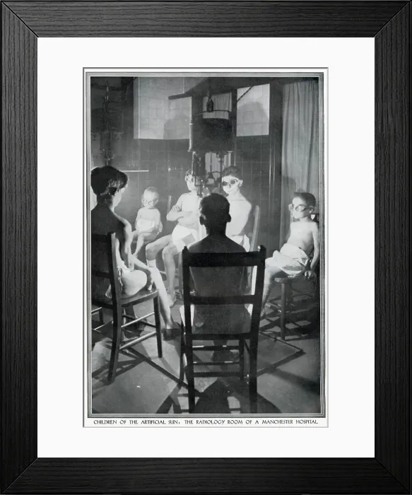Framed Print : A group of children wearing protective goggles are undergoing treatment of radiation therapy, using ultra violet light at Manchester Hospital. Date: 1928