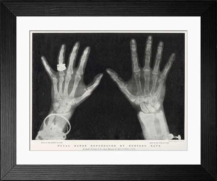 Framed Print : Royal Hands Reproduced by Rontgen Rays Framed Print : Royal Hands Reproduced by Rontgen Rays
