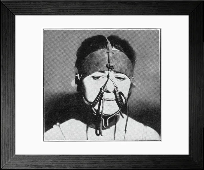 Framed Print : Extreme process of beauty in the parlour of Mme Lina Cavalieri. Woman changing her nasal contours using electrical apparatus strapped around her face, all in the name of fashion. Date: 1927 Framed Print : Extreme process of beauty in the parlour of Mme Lina Cavalieri. Woman changing her nasal contours using electrical apparatus strapped around her face, all in the name of fashion. Date: 1927