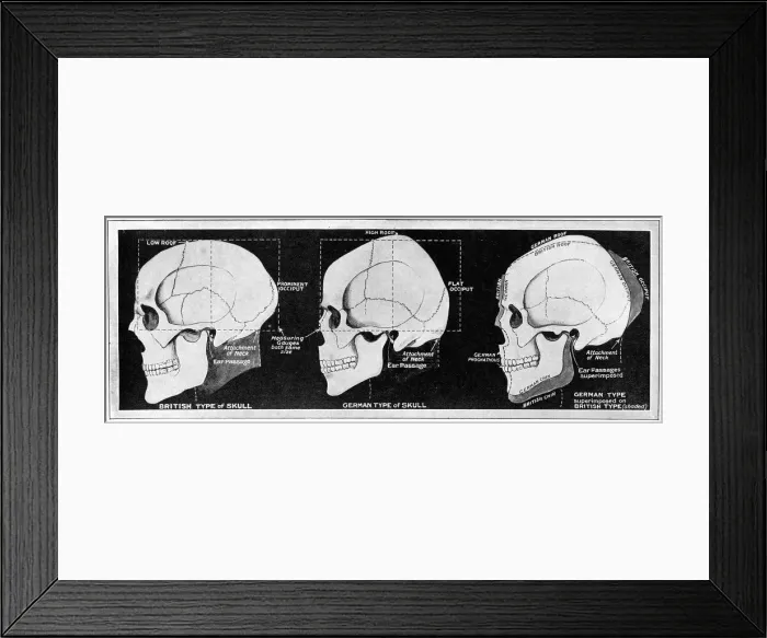 Framed Print : RACIAL CONCEPT / SKULLS Framed Print : RACIAL CONCEPT / SKULLS