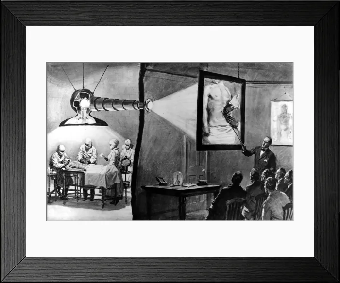 Framed Print : An operation screened live in a medical lecture
