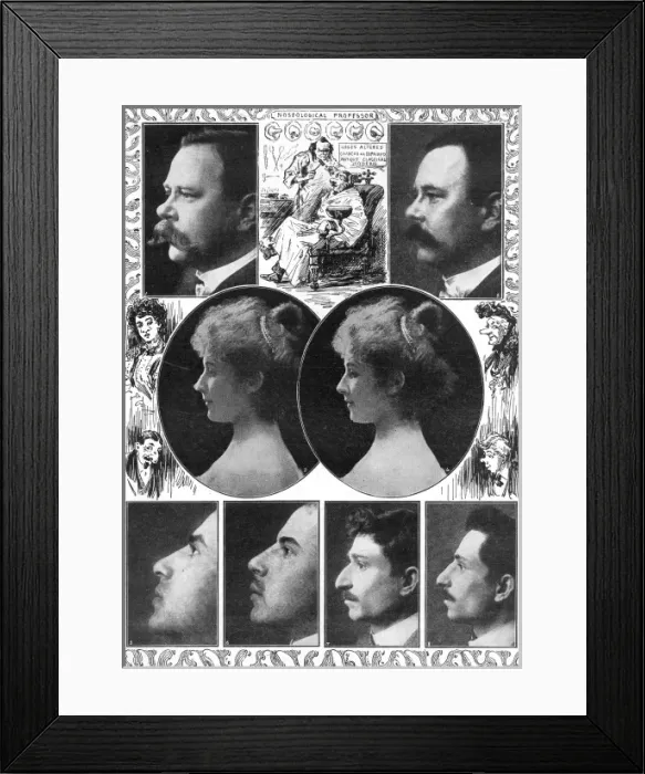 Framed Print : Before and after images of cosmetic surgery Framed Print : Before and after images of cosmetic surgery