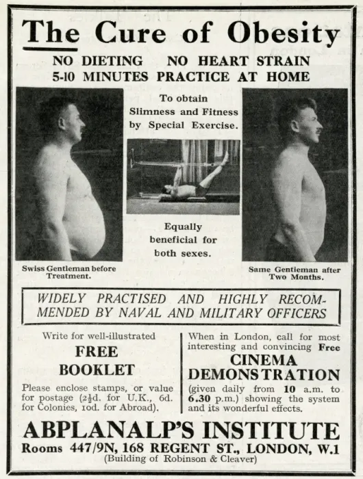 Framed Print : Advert for Abplanalps Institute, cure of obesity 1929 Framed Print : Advert for Abplanalps Institute, cure of obesity 1929