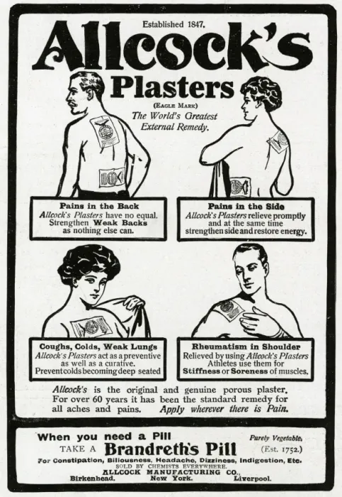 Framed Print : Advert for Allcocks Porous Plasters for aches and pains WWI Framed Print : Advert for Allcocks Porous Plasters for aches and pains WWI