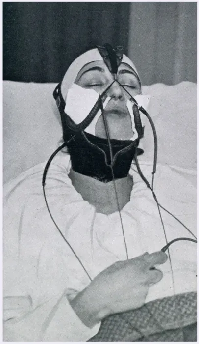 Framed Print : Apparatus for the Removal of the Double Chin 1927