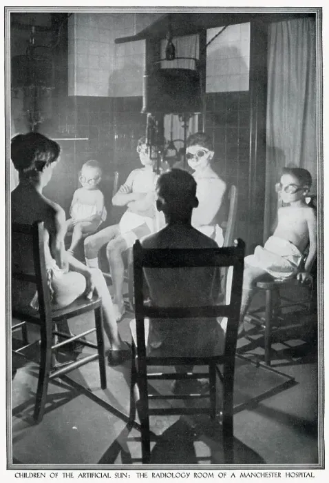 Framed Print : A group of children wearing protective goggles are undergoing treatment of radiation therapy, using ultra violet light at Manchester Hospital. Date: 1928