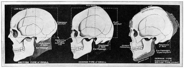 Framed Print : RACIAL CONCEPT / SKULLS Framed Print : RACIAL CONCEPT / SKULLS