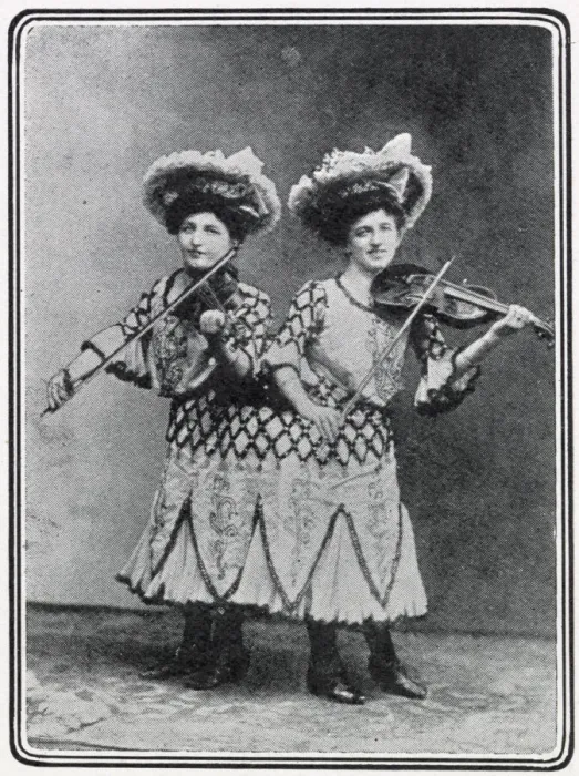Framed Print : Siamese twins, Rosa and Josphine Blazek 1910 Framed Print : Siamese twins, Rosa and Josphine Blazek 1910