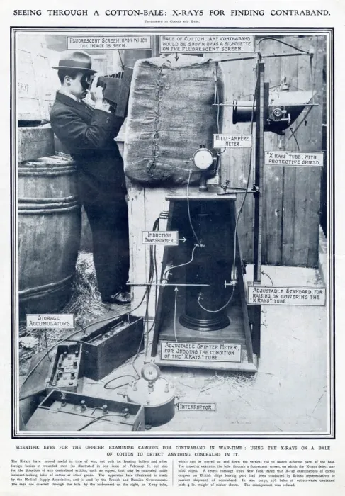 Framed Print : X-ray had proven useful in World War One, for locating bullets Framed Print : X-ray had proven useful in World War One, for locating bullets
