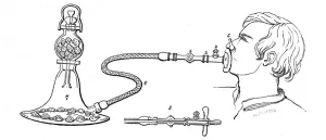 2004 Prints: A anaesthetic apparatus