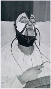Twenties Prints: Apparatus for the Removal of the Double Chin 1927