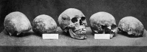 Bones Prints: Believed to be the skull of Alfred the Great