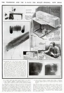 Military Prints: New Ideas for using X-Rays for Medical use WWI