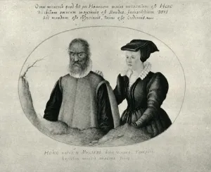 16th Prints: Pedro Gonzalez, the hairy man