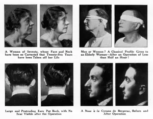 Cosmetics Prints: Plastic Surgery - Before and After